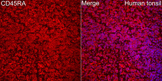 Human CD45RA Polyclonal Antibody (CAB24839)