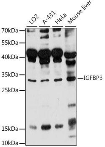 Anti-IGFBP3 Antibody (CAB16052)