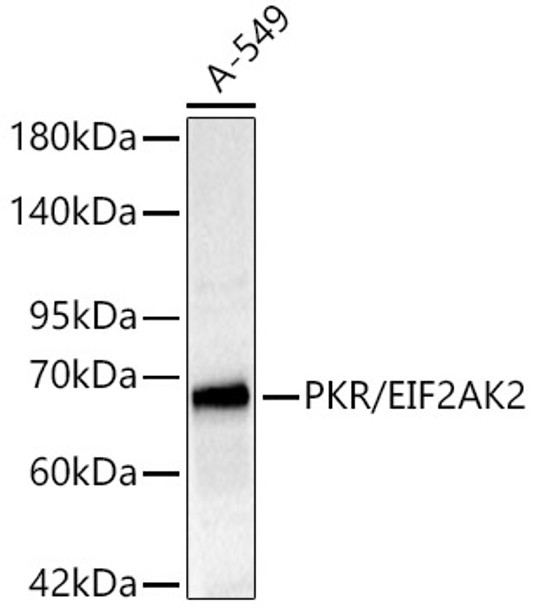 PKR/EIF2AK2 Polyclonal Antibody (CAB4047)