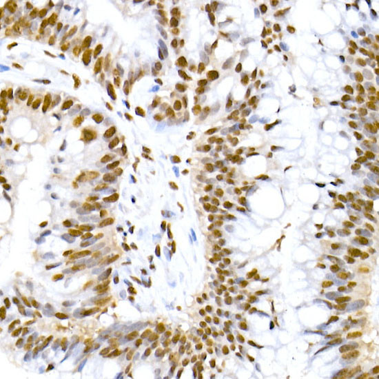 Phospho-MDM2-S166 Monoclonal Antibody (CABP1308)