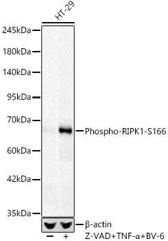 Phospho-RIPK1-S166 Monoclonal Antibody (CABP1448)