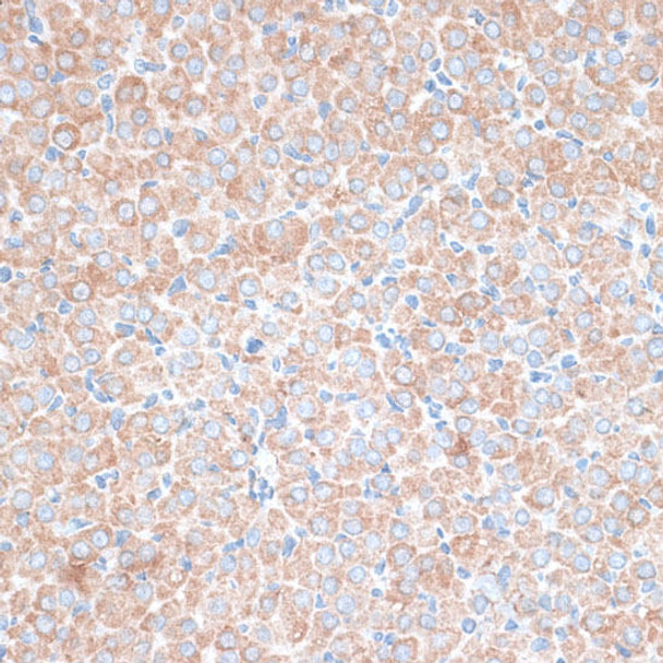 Anti-PMEPA1 Antibody (CAB16555)