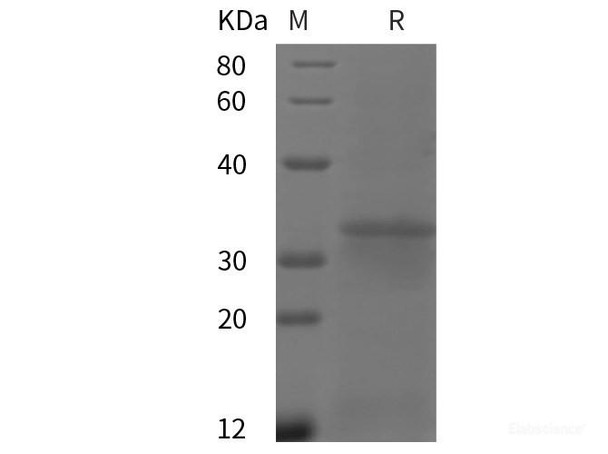 Human FCGR1A/CD64 Recombinant Protein (His tag) (RPES6039)