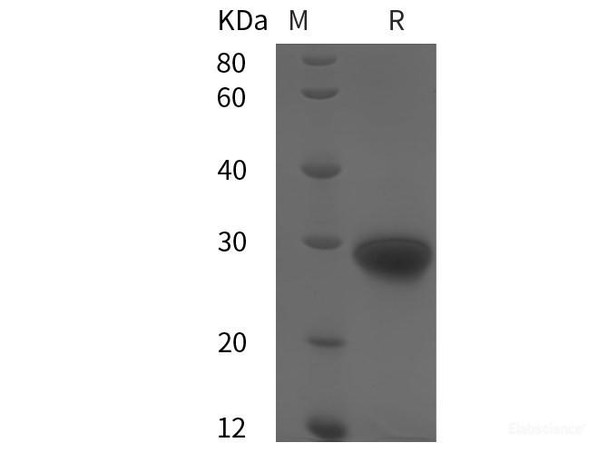 Human TIMP-1 Recombinant Protein (His tag) (RPES6042)