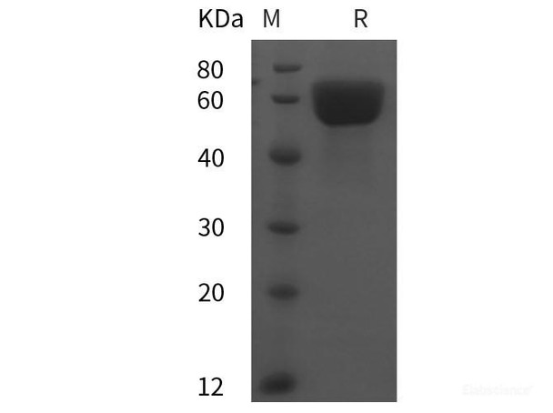 Rat Angiotensinogen/AGT Recombinant Protein (His tag) (RPES6151)