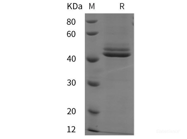 Rat Interleukin-12 subunit beta/IL-12B Recombinant Protein (His tag) (RPES6158)