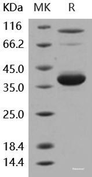 Human IL-8/CXCL8 Recombinant Protein (aa 28-99, Fc Tag) (RPES6165)