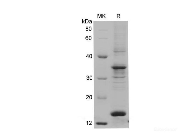 Human S100A9 Recombinant Protein (His Tag) (RPES6186)