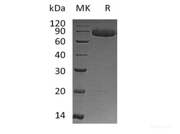 Recombinant Human IL-12 Receptor Subunit Beta1/IL-12RB1/CD212 (C-6His) (RPES6194)