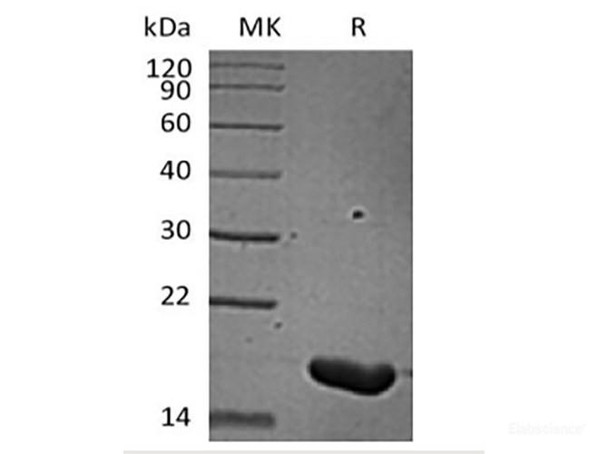 Recombinant Human IL-36 Beta/IL-1F8(157AA) (RPES6196)