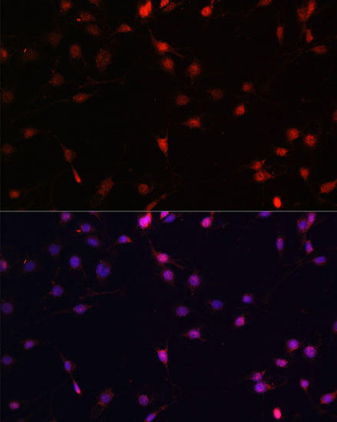 Anti-c-Fos Antibody (CAB16641)