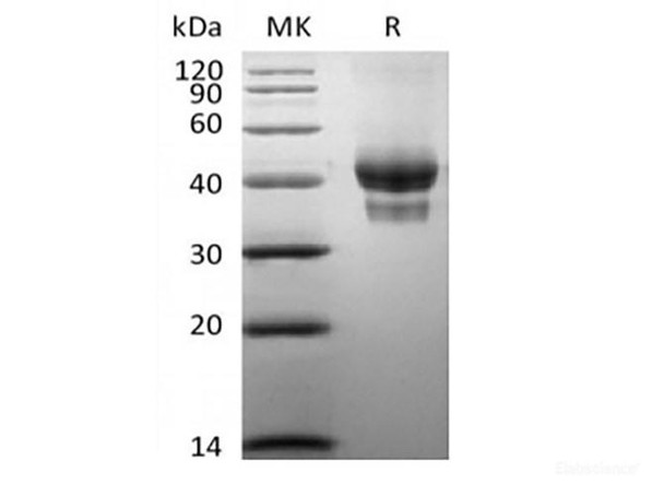 Recombinant Human BCMA/TNFRSF17 (C-Fc-Avi) Biotinylated (RPES6209)