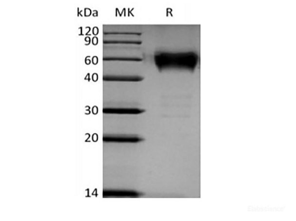 Recombinant Human B- and T-Lymphocyte Attenuator/BTLA/CD272 (C-mFc) (RPES6213)