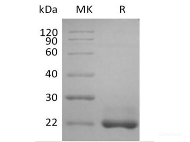 Recombinant Human TNFSF13B/BAFF/CD257 (N-6His) (RPES6217)