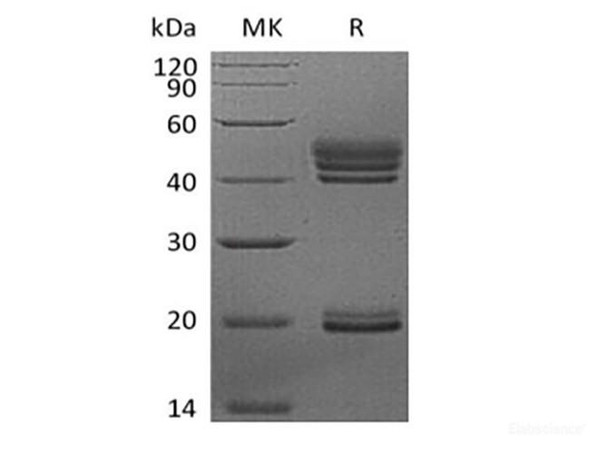 Recombinant Human Interleukin-23/IL-23 (C-6His) (RPES6229)