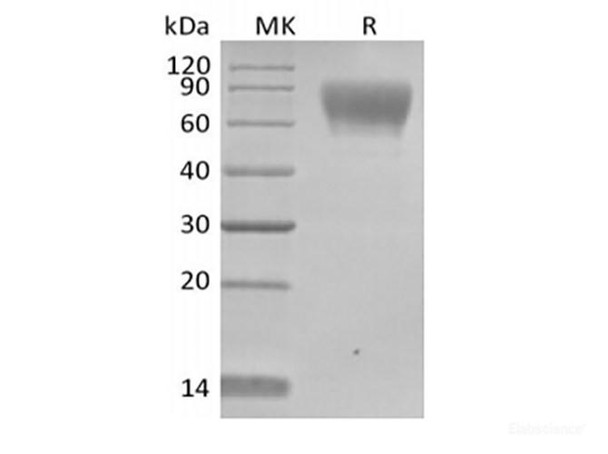 Recombinant Human TPBG/5T4 (C-Avi-6His) Biotinylated (RPES6240)