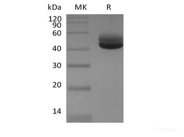 Recombinant Human IL-4 (C-Fc) (RPES6263)