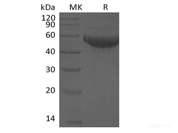 Recombinant Human Siglec-8 (C-6His) (RPES6286)