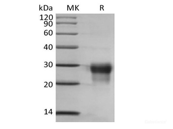 Recombinant Human Placenta Growth Factor/PGF/PIGF/PLGF (C-6His) (RPES6287)