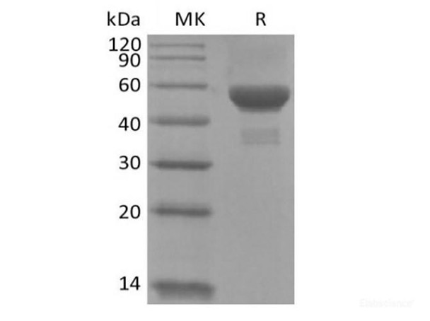 Recombinant Human Carbonic Anhydrase IX/CA9 (C-6His) (RPES6290)