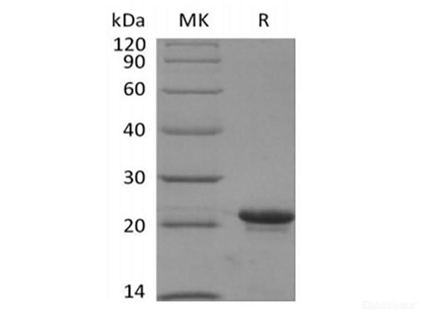 Recombinant Human KRAS4B(G12V, N-6His) (RPES6302)