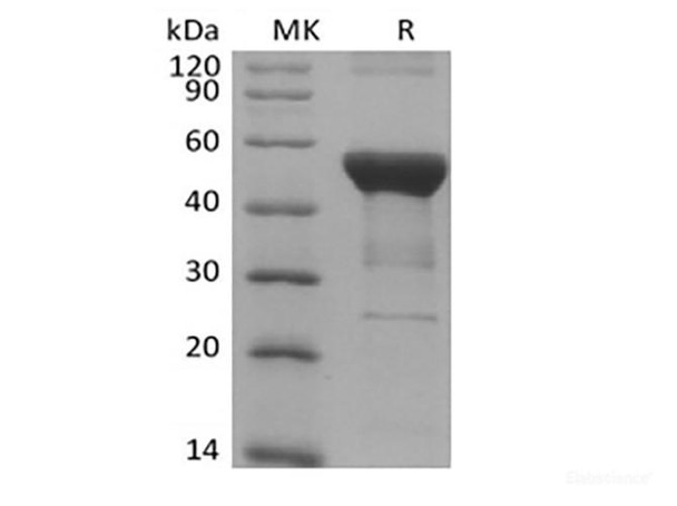 Recombinant Human NFKB1 (N-6His) (RPES6304)