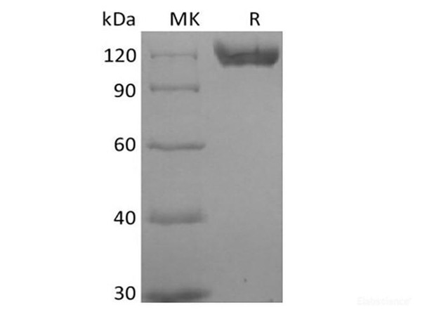 Recombinant Human B-cell Receptor CD22/Siglec-2/CD22 (C-6His) Biotinylated (RPES6306)