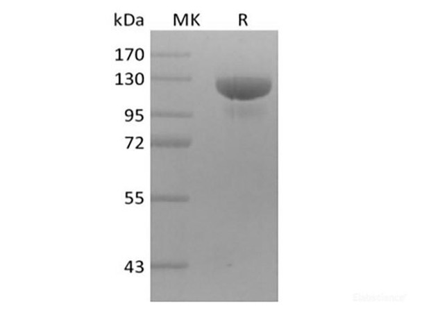 Human Receptor Tyrosine-Recombinant Protein Kinase ErbB-3/HER3 (C-mFc) (RPES6315)