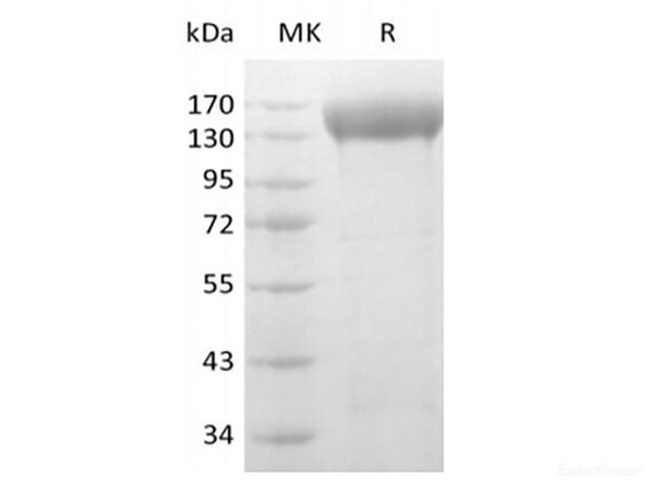 Human VEGF Receptor 2/VEGF R2/FLK-1/KDR (C-6His-Avi) Biotinylated (RPES6319)