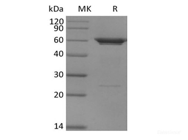 Recombinant Human PFKFB3 (N-6His) (RPES6321)