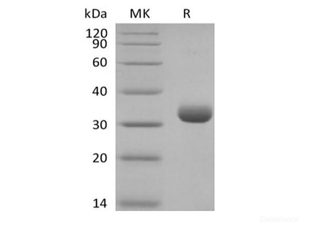Recombinant Human Butyrophilin Subfamily 3 Member A2/BTN3A2 (C-6His-Avi) Biotinylated (RPES6348)