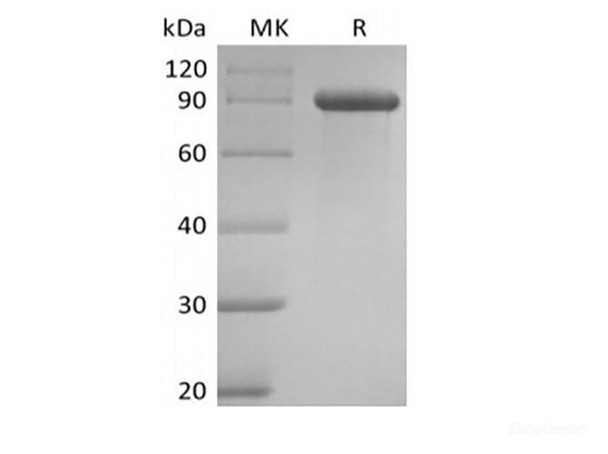 Human Delta-like Recombinant Protein 1/DLL1 (C-Fc) (RPES6386)