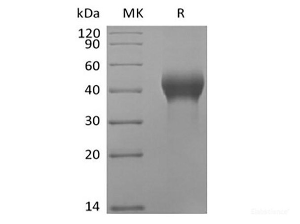 Human Dickkopf-Related Recombinant Protein 1/DKK-1 (C-Avi-6His) Biotinylated (RPES6390)