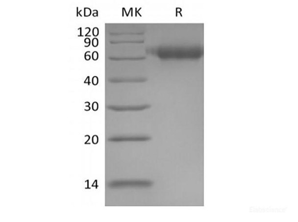 Human IL-1 Receptor Accessory Recombinant Protein/IL-1RAcP/IL-1R3 (C-6His) (RPES6396)