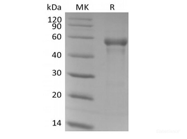 Recombinant Human B3GAT1 (N-6His) (RPES6401)