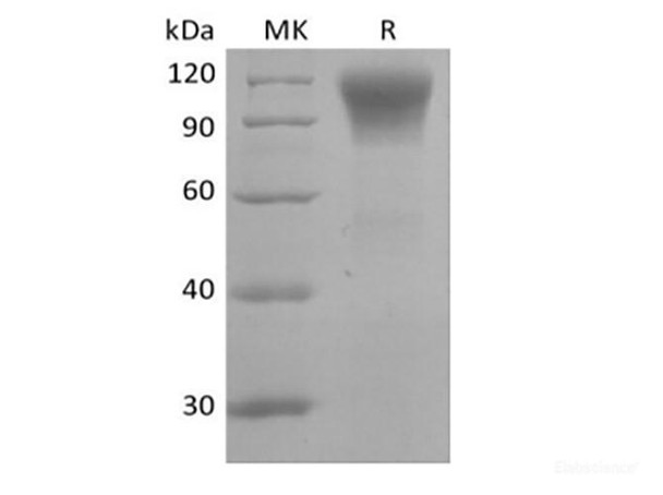 Recombinant Human CD45R0 (C-6His) (RPES6406)