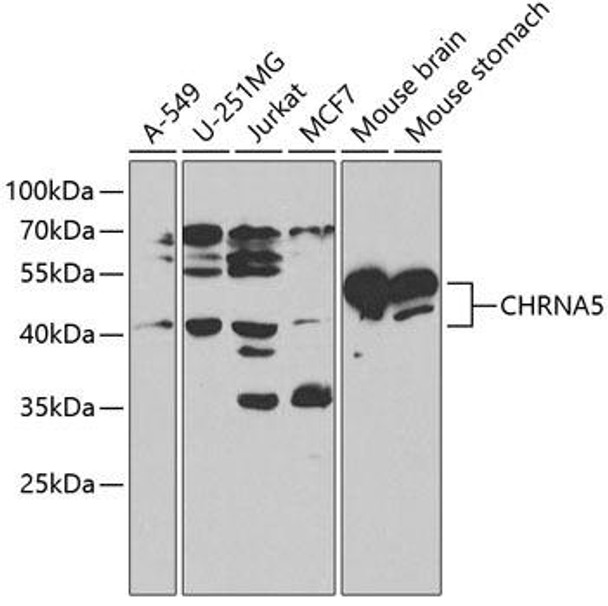 Anti-CHRNA5 Antibody (CAB1741)