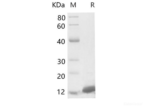 Human S100A11 Recombinant Protein (His Tag) (RPES6516)