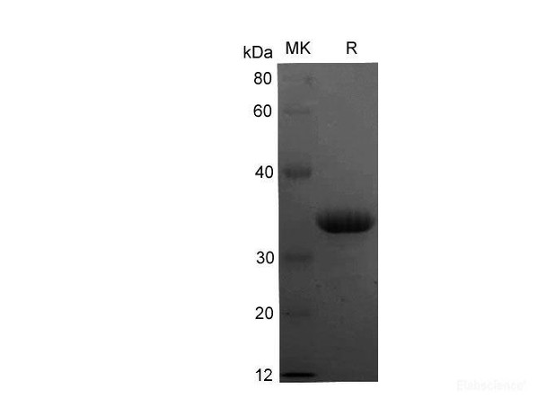 Human CXCR4 (C28A) Recombinant Protein (His Tag) (RPES6530)
