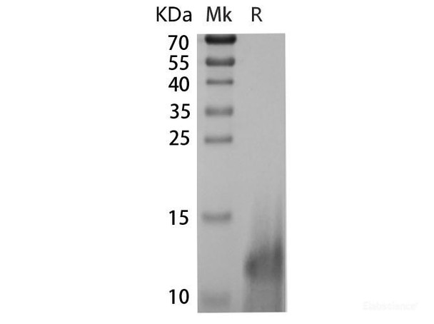 Human IL-5 Recombinant Protein (RPES6541)