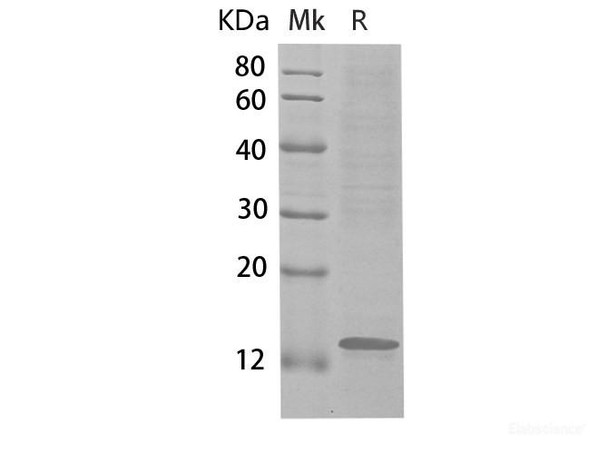 Human CCL14 Recombinant Protein (RPES6549)