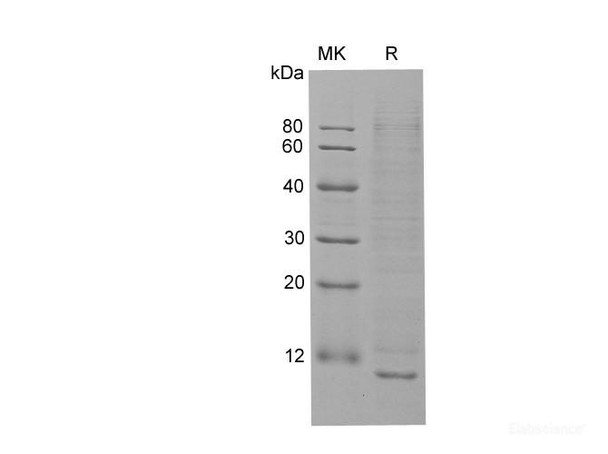 Human CXCL13/BCA-1 Recombinant Protein (RPES6557)
