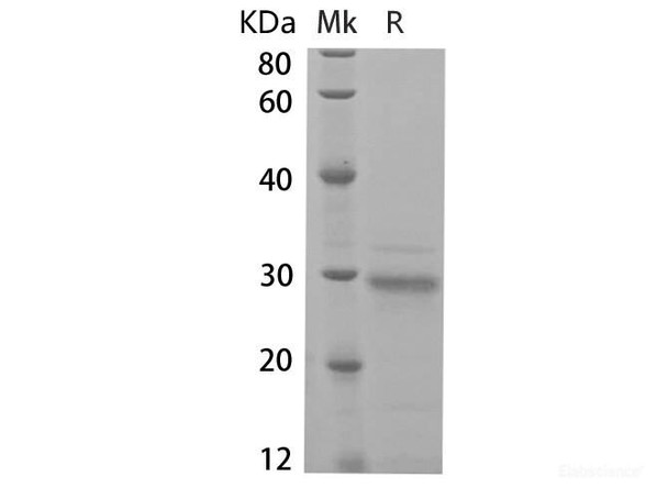 Human HIF1A Recombinant Protein (RPES6559)