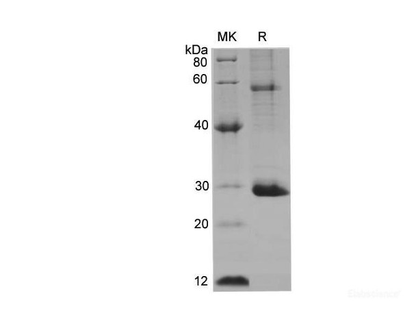 Mouse AKT1 Recombinant Protein (His Tag) (RPES6614)