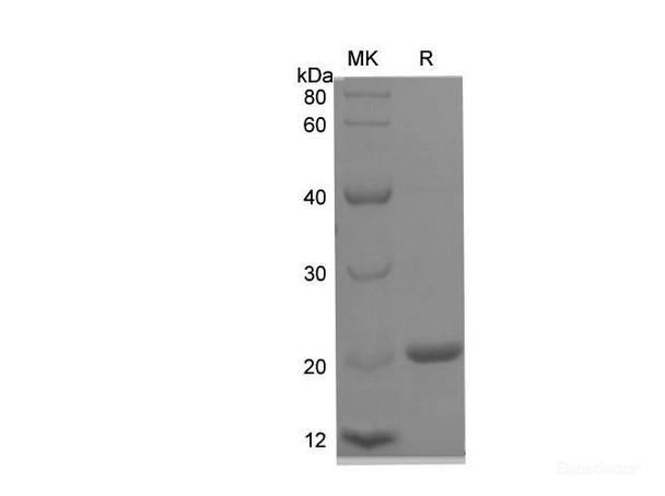 Mouse IL2 Recombinant Protein (His Tag) (RPES6620)