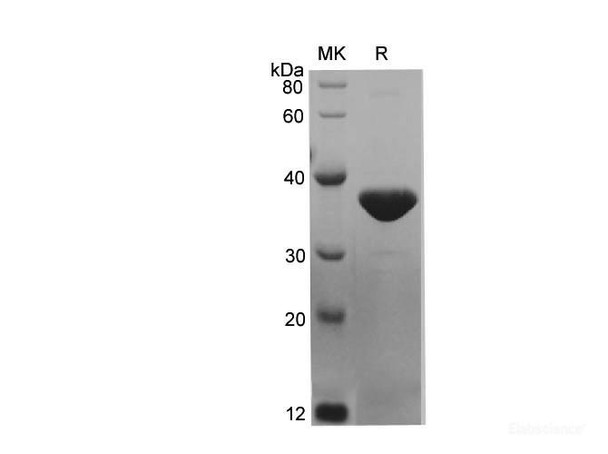 Mouse KRT7 Recombinant Protein (His Tag) (RPES6622)