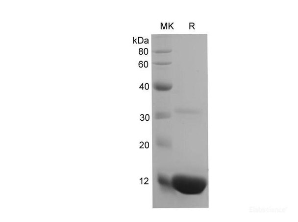Mouse B2M/Î²2-MG Recombinant Protein (His Tag) (RPES6625)