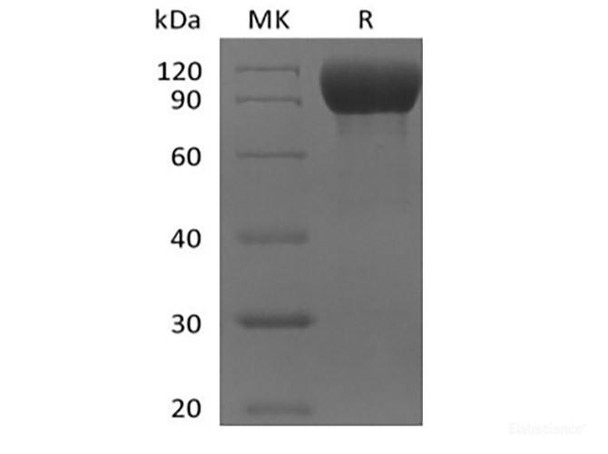 Recombinant Mouse IL-1 Receptor-Like 2/IL-1RL2/IL-1Rrp2/IL-36R (C-Fc) (RPES6634)