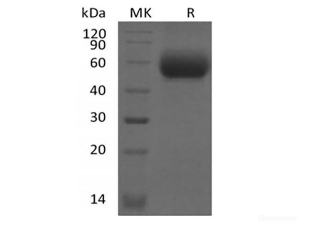 Recombinant Mouse IL-1 Receptor-Like 2/IL-1RL2/IL-1Rrp2/IL-36R (C-6His) (RPES6639)