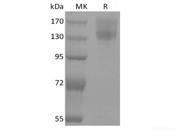 Recombinant Mouse Leptin Receptor/LEPR/CD295 (C-mFc) (RPES6648)